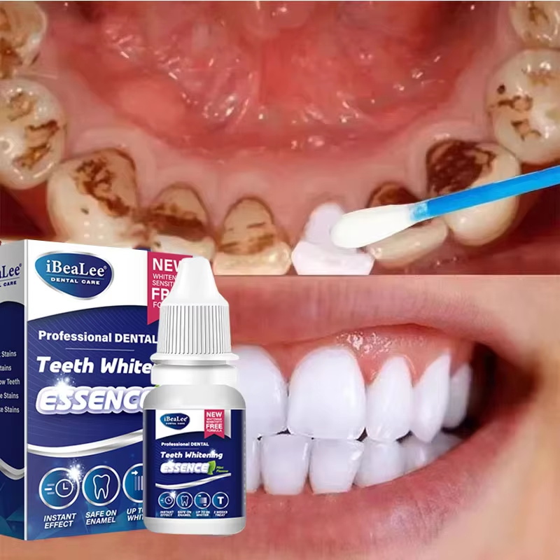Teeth Whitening Serum - 歯のホワイトニングエッセンス 歯垢汚れ除去セラム フレッシュブレス 口腔衛生 歯の虫歯予防 歯のクリーニング