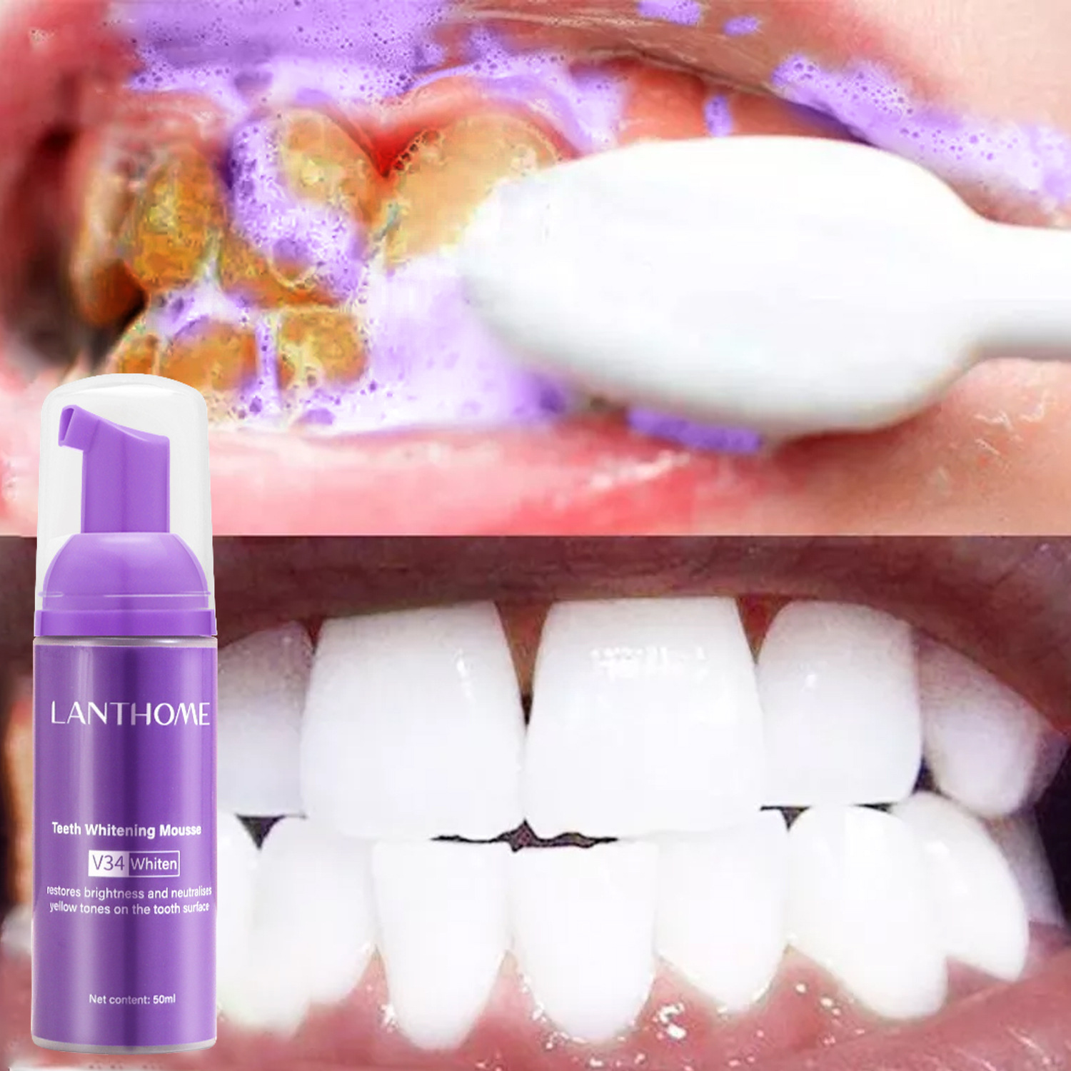 Teeth Whitening/Bleaching - V34 ホワイトニングムース歯磨き粉 歯垢除去 ステイン除去 口腔衛生 ブリーチング