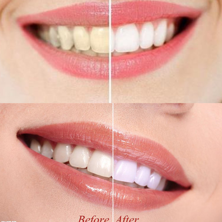 竹炭歯,口腔衛生,煙のホワイトニング,新鮮な呼吸のための歯の - Teeth Whitening Price のレビューと価格