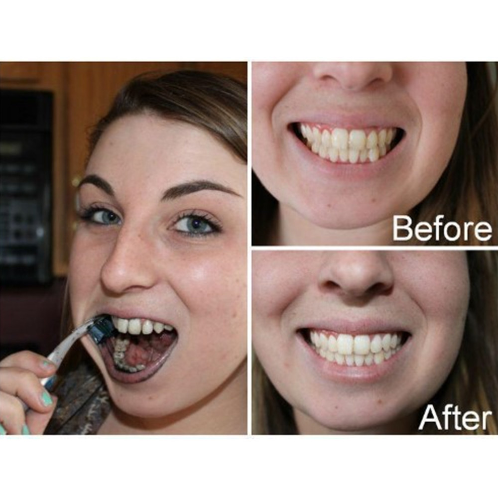 竹炭歯,口腔衛生,煙のホワイトニング,新鮮な呼吸のための歯の - Teeth Whitening Price のレビューと価格