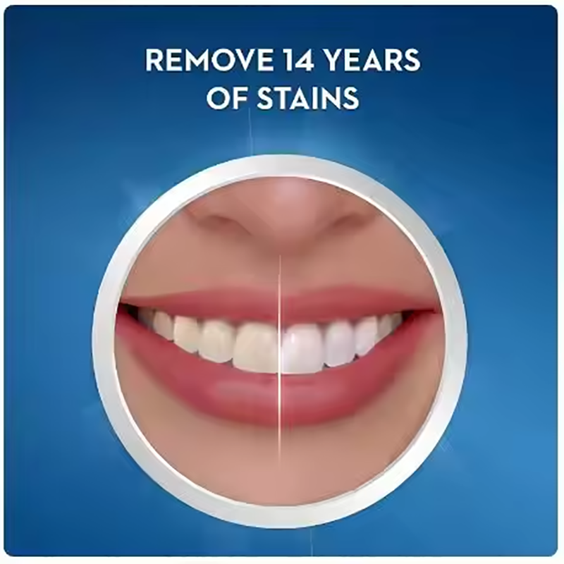 クレスト ホワイトニングストリップス 3Dホワイト プロフェ - Teeth Whitening Effects のレビューと価格