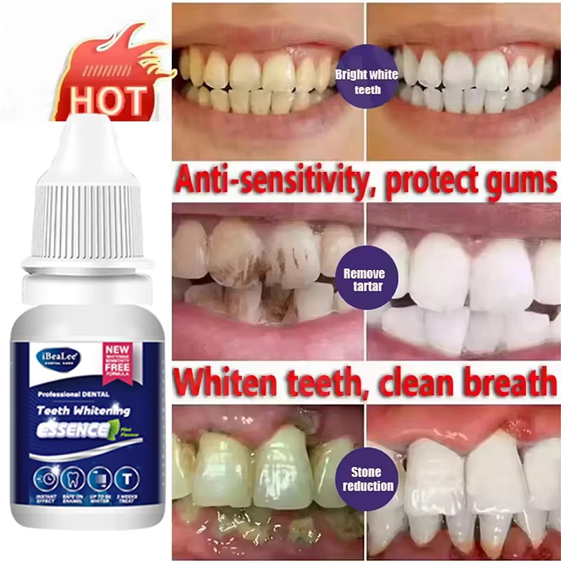 歯のホワイトニングエッセンス 歯垢汚れ除去セラム フレッシュ - Teeth Whitening Serum のレビューと価格