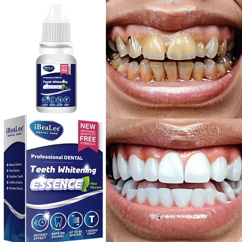歯のホワイトニングエッセンス 歯垢汚れ除去セラム フレッシュ - Teeth Whitening Serum のレビューと価格