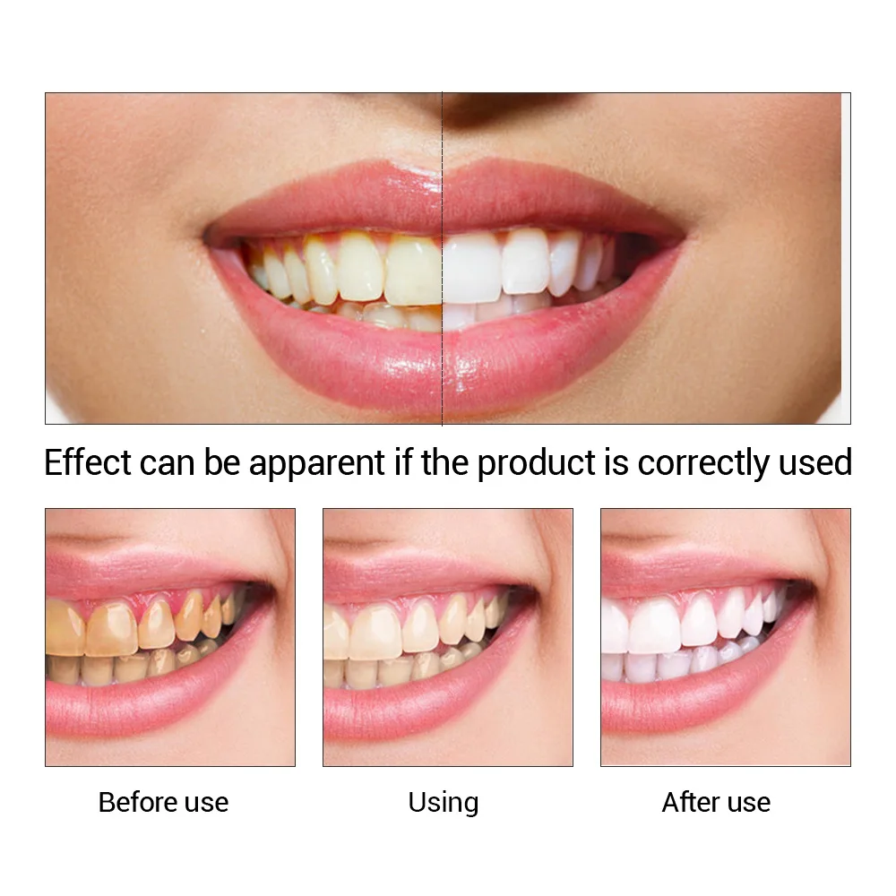 歯のホワイトニングエッセンス,口腔衛生,歯のホワイトニング, - Teeth Whitening Price のレビューと価格