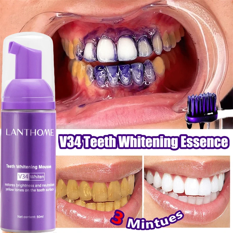 V34 ホワイトニングムース歯磨き粉 歯垢除去 ステイン除去 - Teeth Whitening/Bleaching のレビューと価格