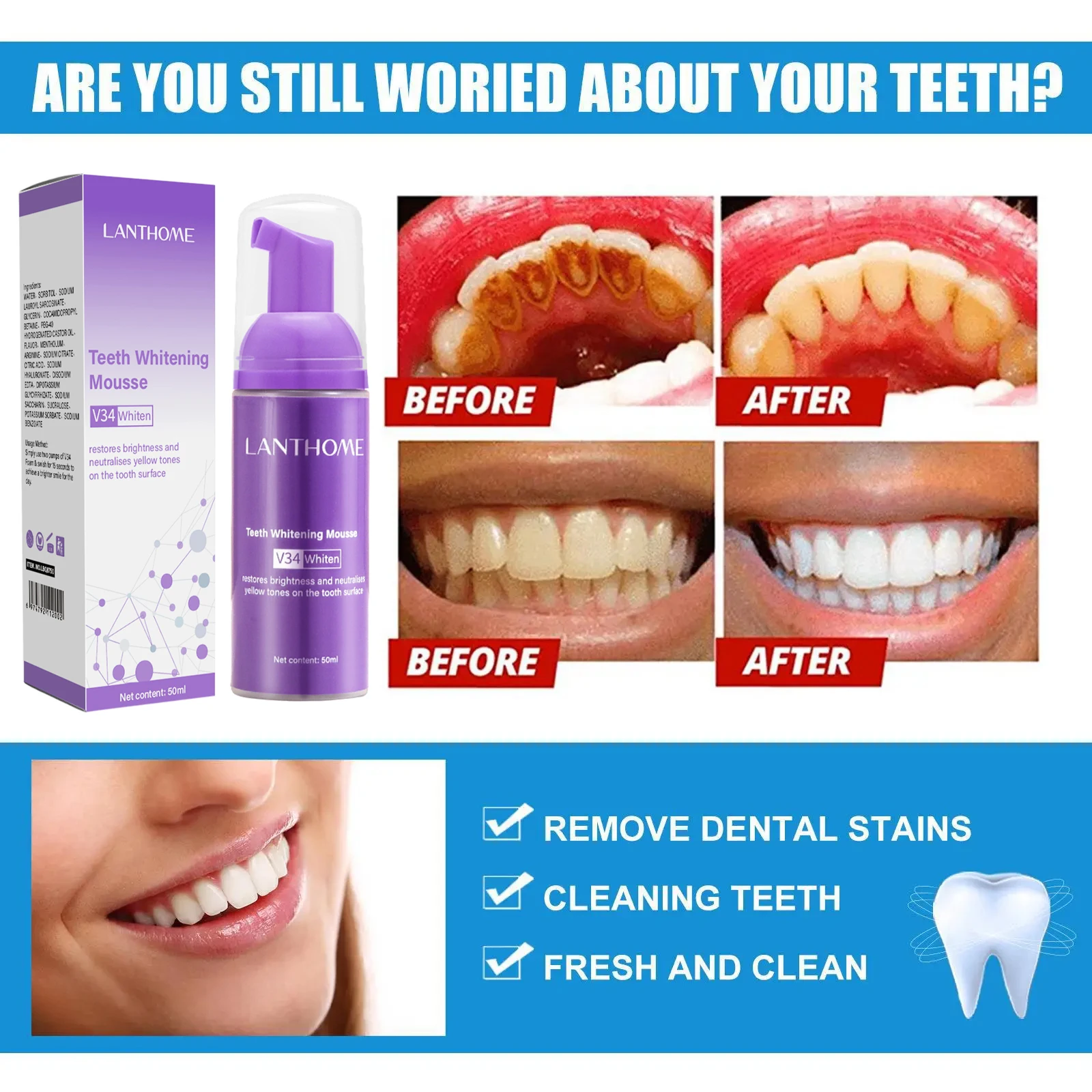 V34 ホワイトニングムース歯磨き粉 歯垢除去 ステイン除去 - Teeth Whitening/Bleaching のレビューと価格