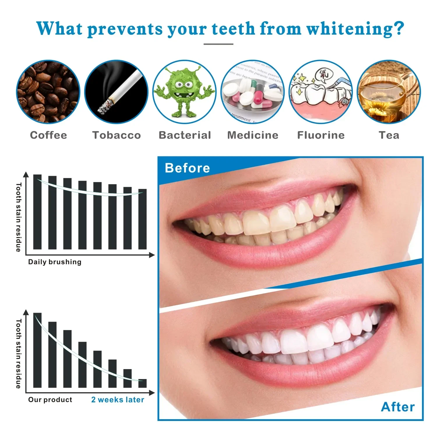 14/28 個 3D 歯ホワイトニングストリップ聖霊降臨祭プ - Teeth Whitening Effects のレビューと価格