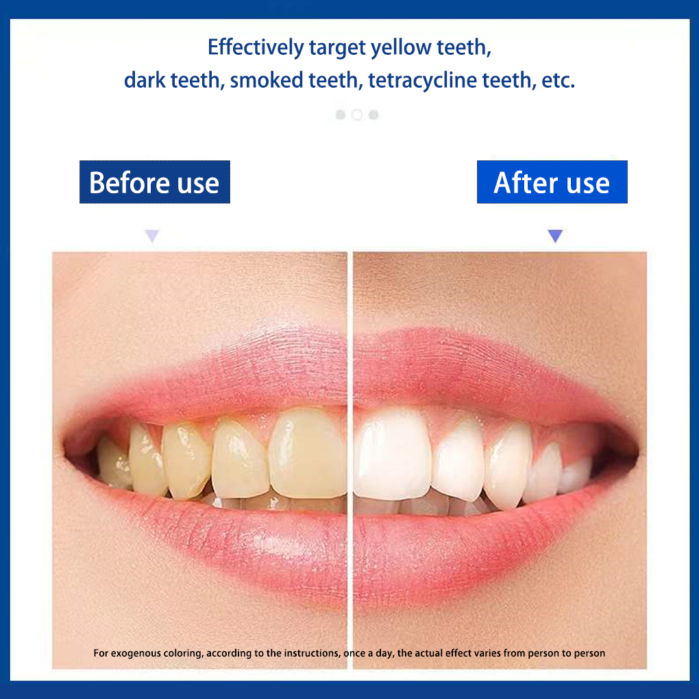 歯のホワイトニングストリップ,プロの効果,歯のホワイトニング - Teeth Whitening Effects のレビューと価格