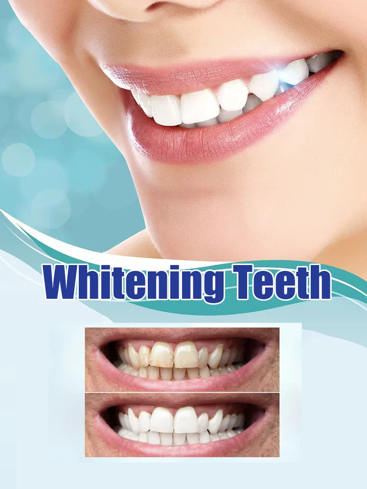 第2世代アップグレード版歯のホワイトニングキット、歯の黄ばみ - Teeth Whitening Serum のレビューと価格