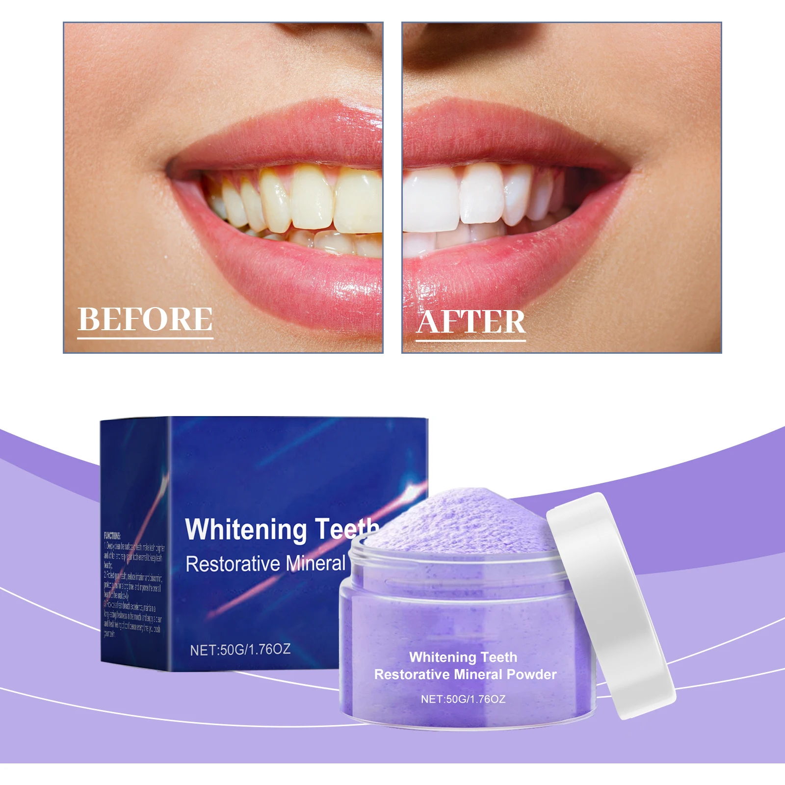 第2世代アップグレード版歯のホワイトニングキット、歯の黄ばみ - Teeth Whitening Serum のレビューと価格