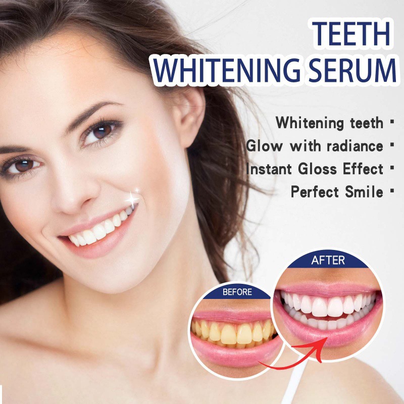 プロフェッショナル歯のホワイトニング美容液、頑固な歯の汚れを - Teeth Whitening Serum のレビューと価格